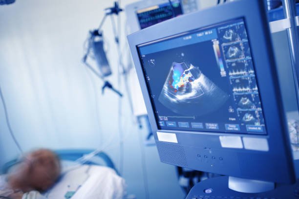 Advanced ICU Monitoring Systems